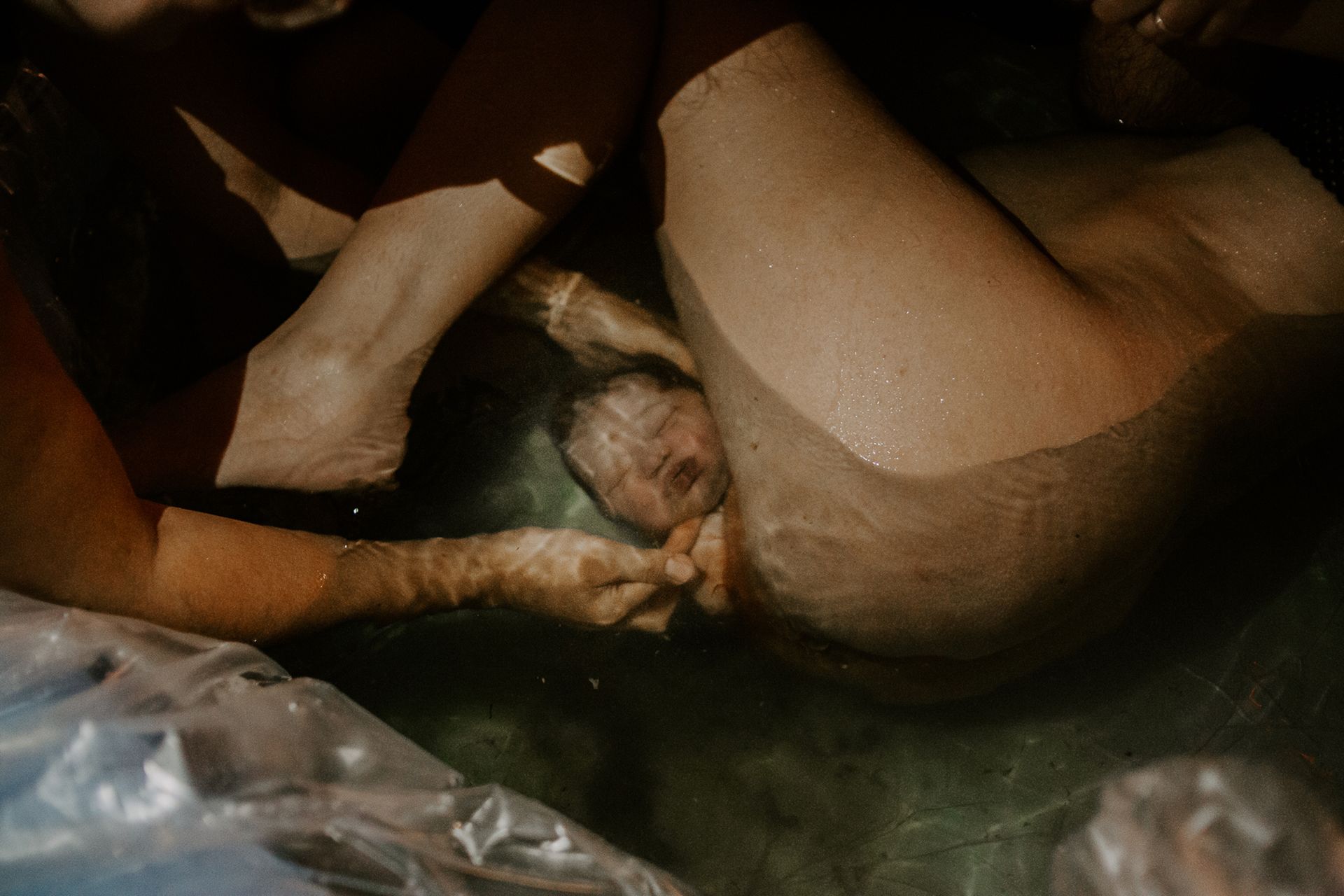 NÃO DIRIGIDAS - 1 - 10