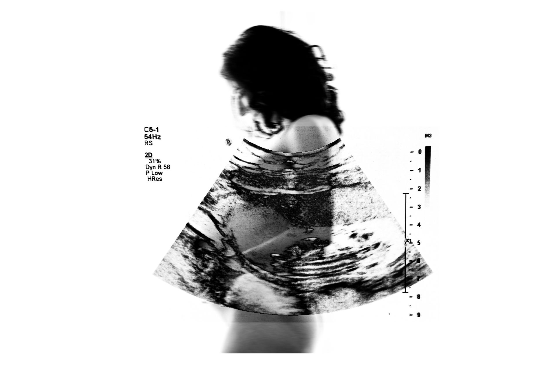 Perda e Processos - 1 - 5