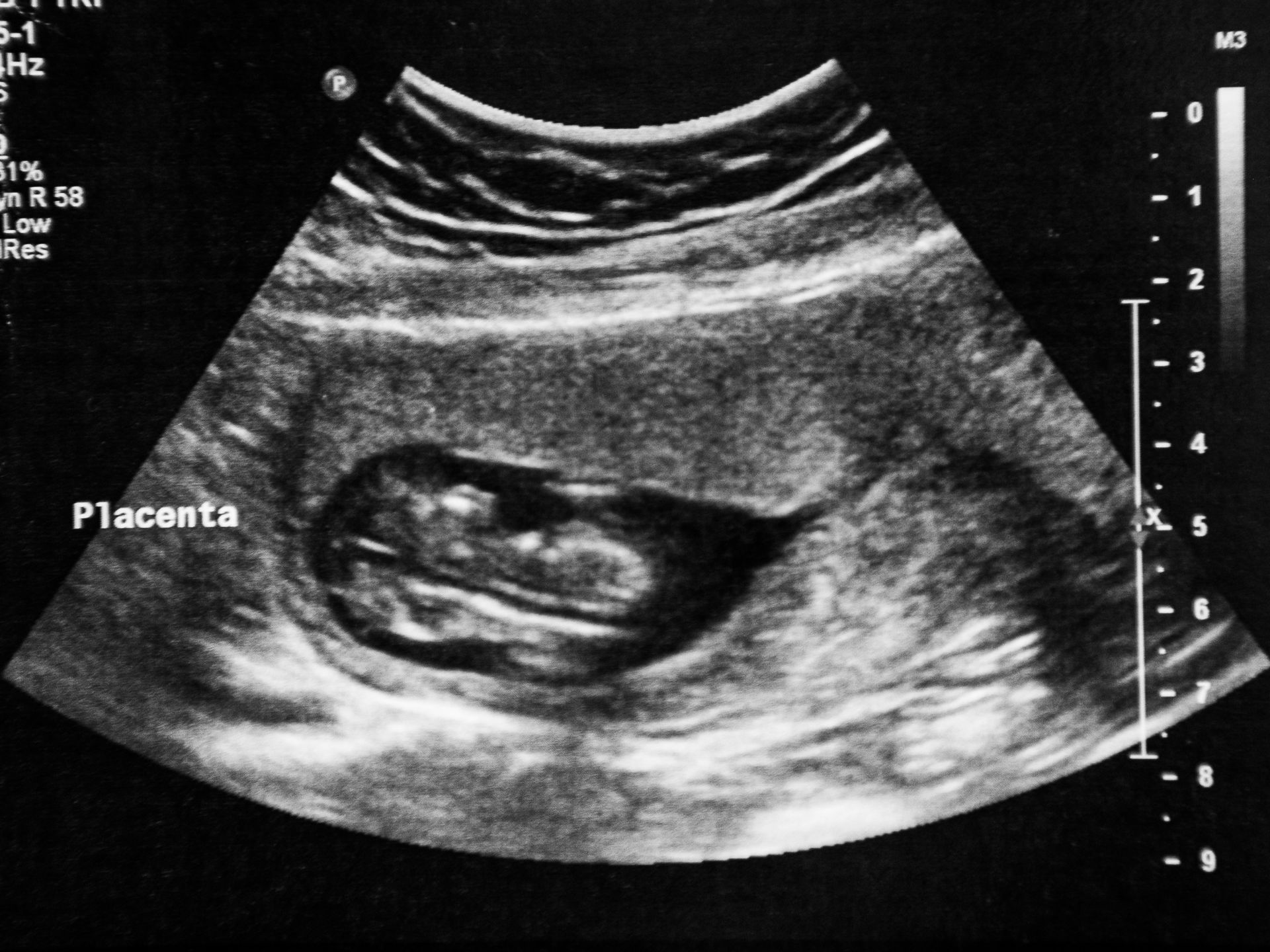 Perda e Processos - 1 - 7