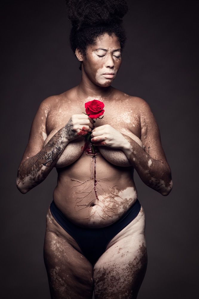 Rooted Love - Amor enraizado - 4 - 2