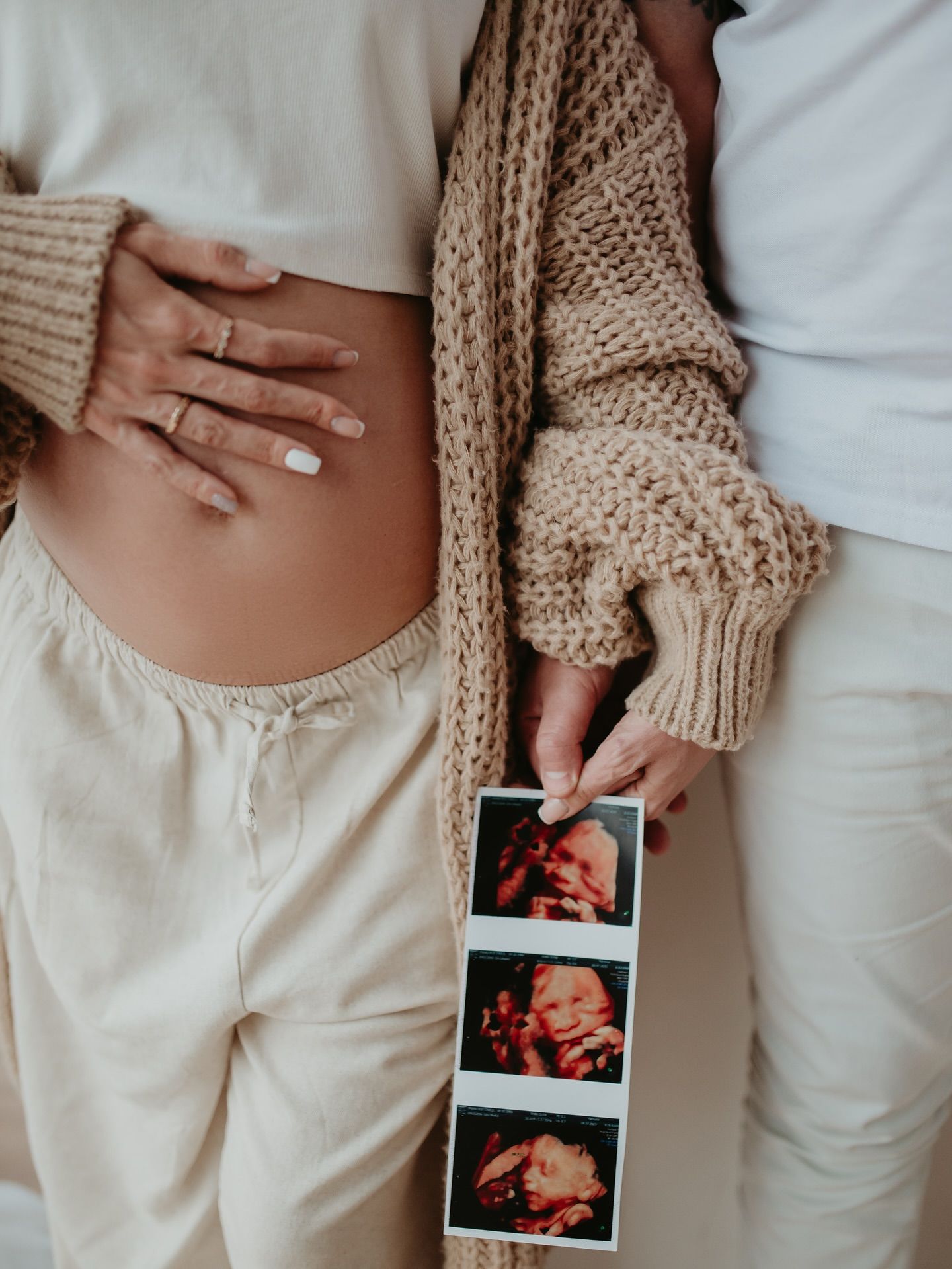 Memórias para o Miguel - 3 - 8