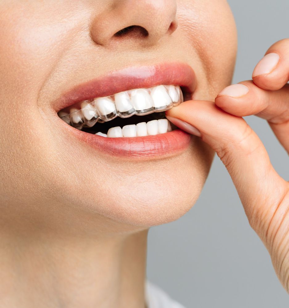 Conheça os tratamentos odontológicos que vão transformar a sua qualidade de vida - 0